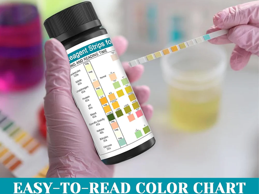 Urine PH Test Strips Protein Ketone Testing Strip - Image 13