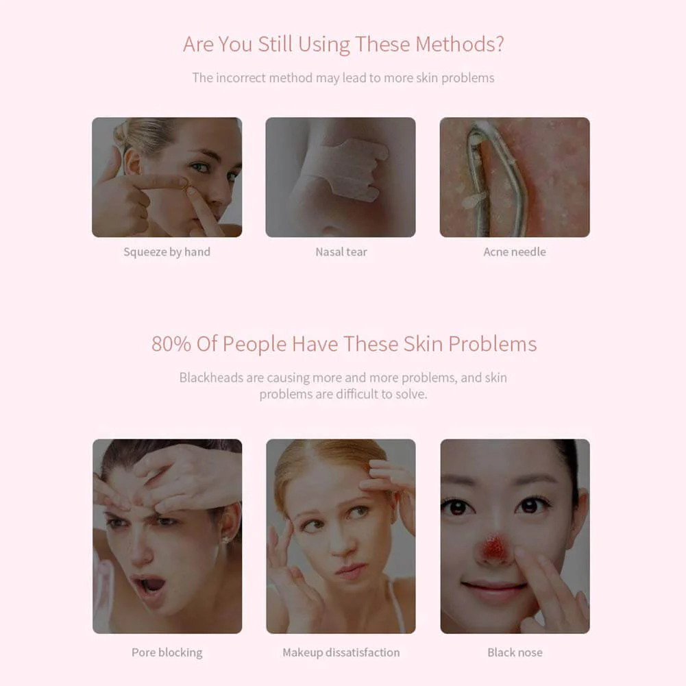 Acne Cleansing Blackhead Remover - Image 8