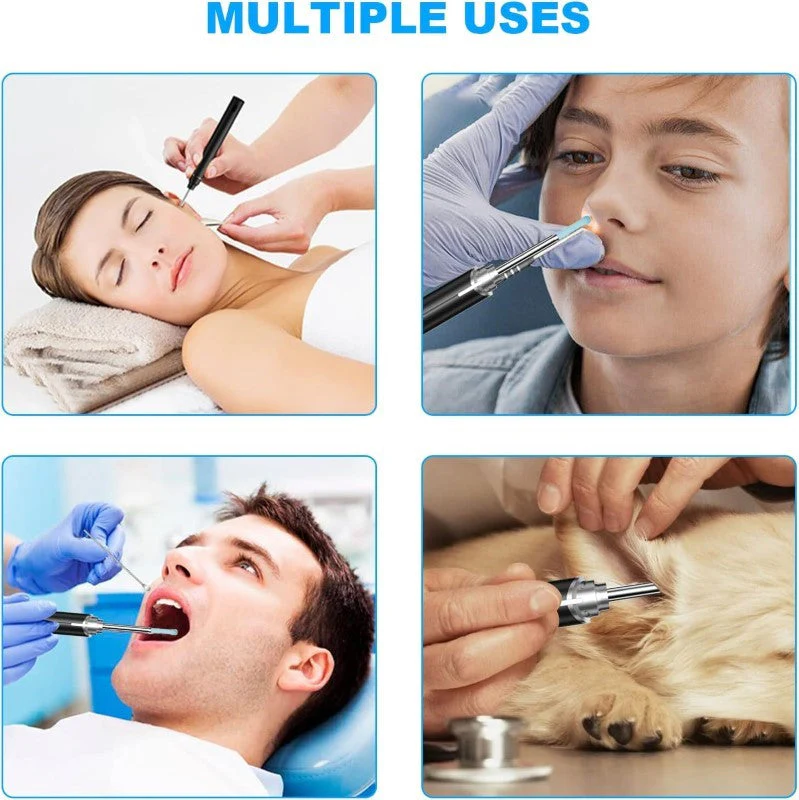 Electric Ear Wax Remover - Image 2