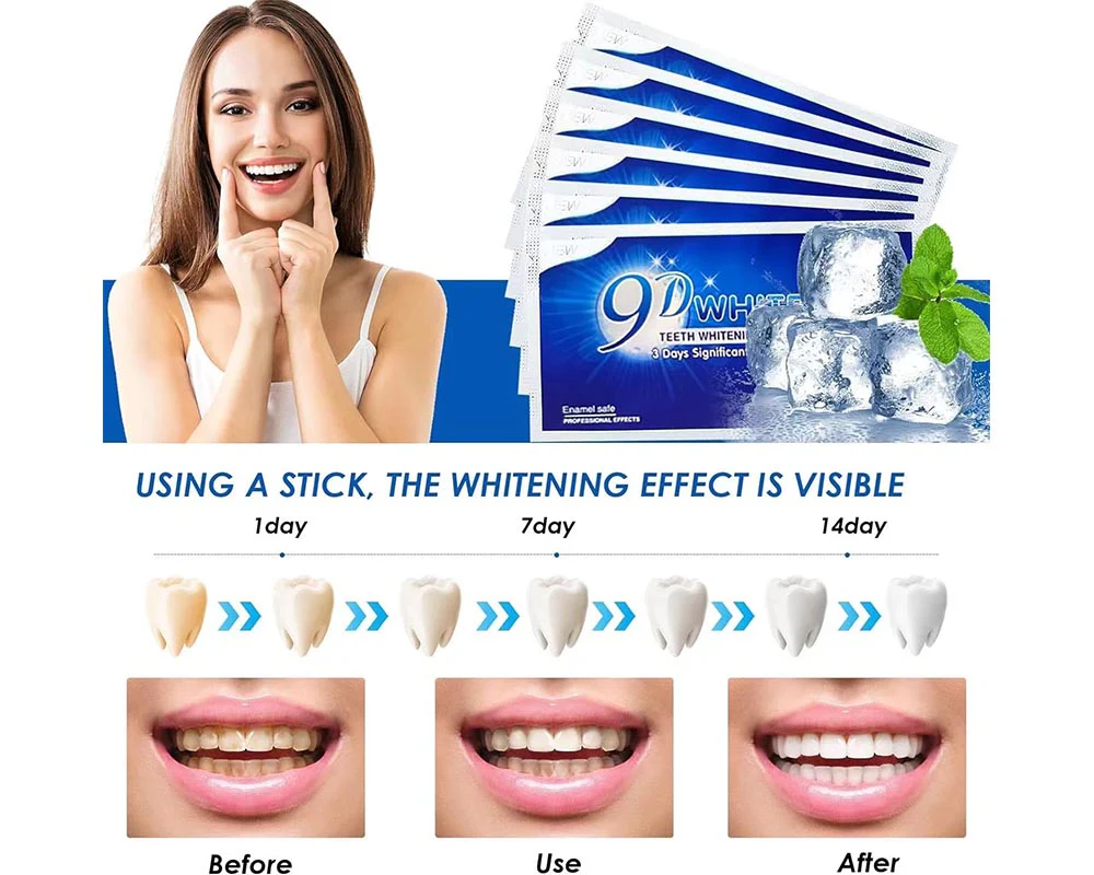 Teeth Whitening Strips kit - Image 3